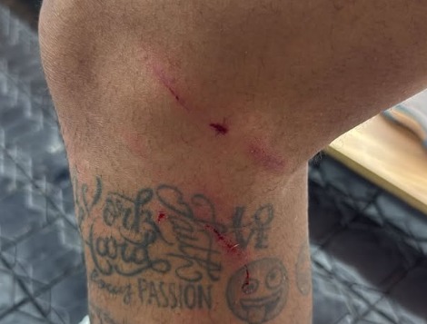 Neymar mostra foto da perna ferida após empate do Santos: “É toda vez isso”