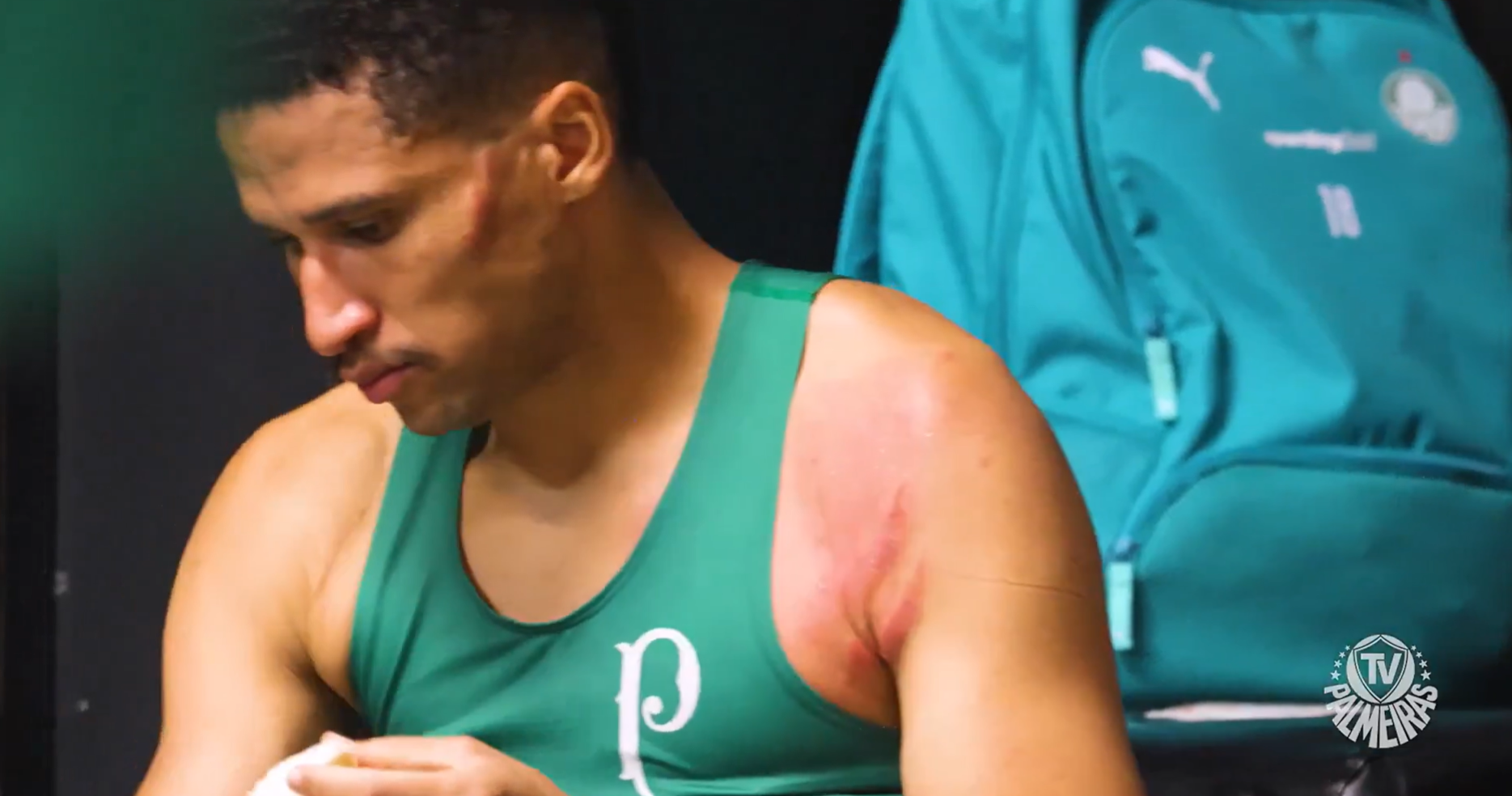Palmeiras exibe cicatrizes de Murilo e alfineta Carrascal com 