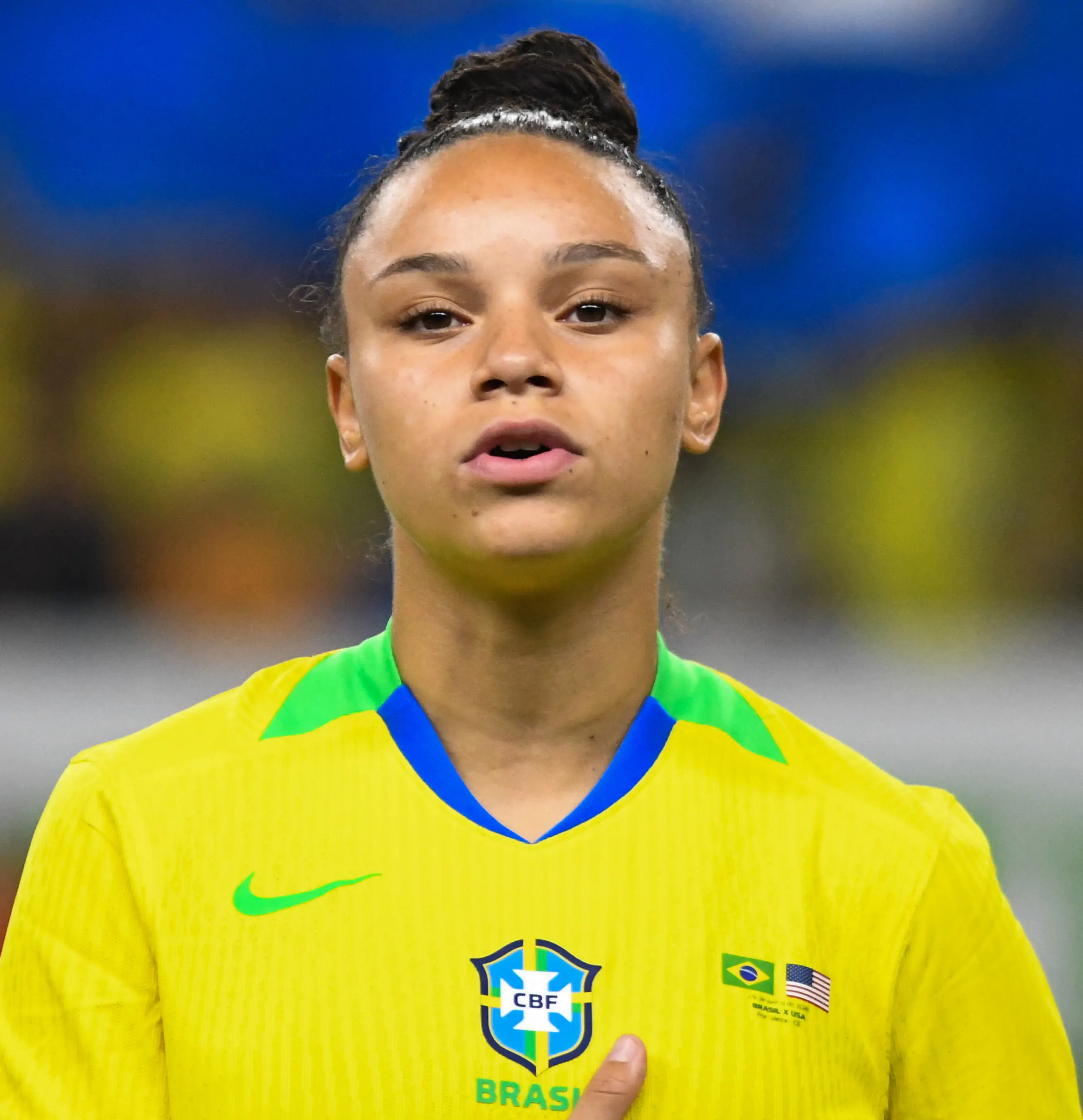 CBF confirma lesão grave de Dudinha após amistoso da Seleção