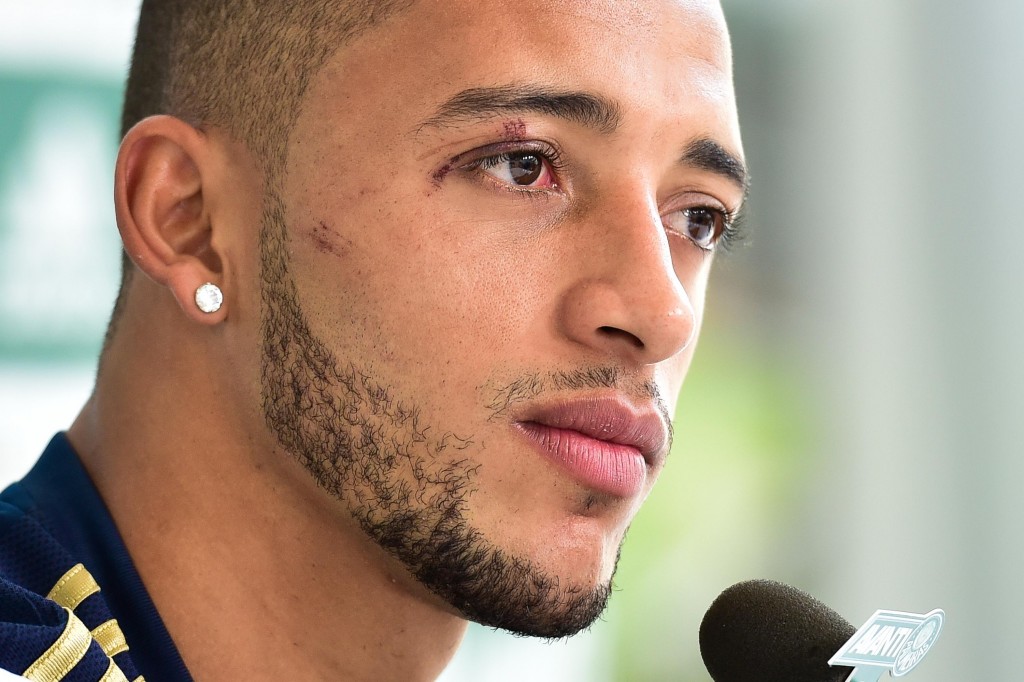Zagueiro ainda tem cicatrizes do soco acidental que levou no gol de sábado (Foto: Fernando Dantas/Gazeta Press)
