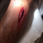 Clube mineiro publicou em seu perfil no Twitter uma imagem mostrando corte sofrido pelo argentino (Bruno Cantini/CAM)
