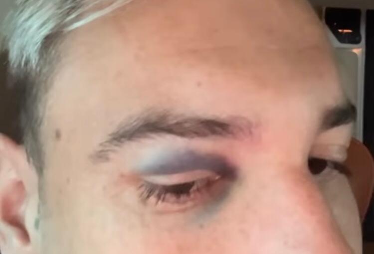 Róger Guedes mostra olho roxo após choque em vitória do Corinthians